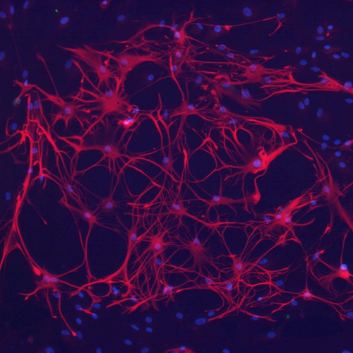 Oddelenie-neurodegeneracie-plasticity-a-reparacie