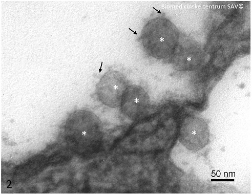 Detail vírusových častíc (biele hviezdičky). Šípky – glykoproteínové výbežky (tzv. Spike protein) na povrchu vírusových častíc, voči ktorému je zacielená väčšina vyvíjaných vakcín. (50 nm=0,00000005 m)