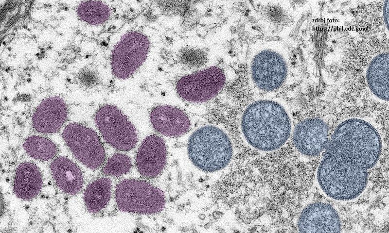 Digitálne dofarbený obrázok znázorňuje vírusové častice vírusu opičích kiahní, ako je ich možno pozorovať v elektrónovej mikroskopii. Na ľavej strane sa nachádzajú zrelé vírusové častice oválneho tvaru (dofarbené fialovou farbou) a na pravej strane sú sférické častice nezrelých častíc (dofarbené modrou farbou).