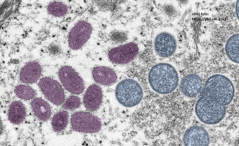 Digitálne dofarbený obrázok znázorňuje vírusové častice vírusu opičích kiahní, ako je ich možno pozorovať v elektrónovej mikroskopii. Na ľavej strane sa nachádzajú zrelé vírusové častice oválneho tvaru (dofarbené fialovou farbou) a na pravej strane sú sférické častice nezrelých častíc (dofarbené modrou farbou).