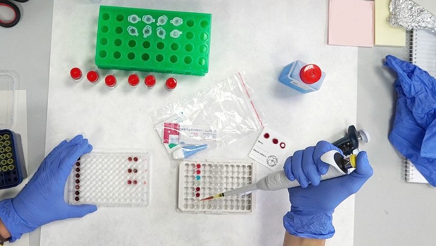 Práca v laboratóriu v rámci séroepidemiologickej štúdie zamestnancov SAV – jeseň 2022