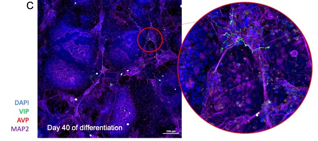 Illustrative image related to Prof. Qutub's research in the field of the brain.