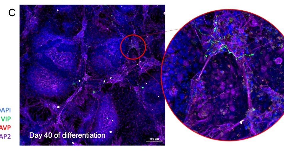 Illustrative image related to Prof. Qutub's research in the field of the brain.